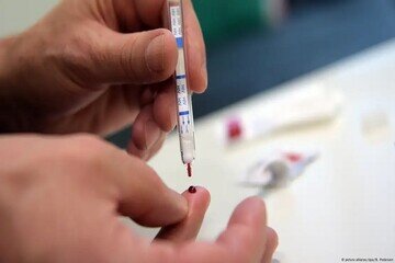از زندان تا زندگی؛ روایتهایی از امید در مراکز درمان HIV