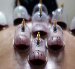 حجامت توسط افراد غیر متخصص خطرناک است