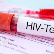 مهمترین چالش امروز HIV در ایران